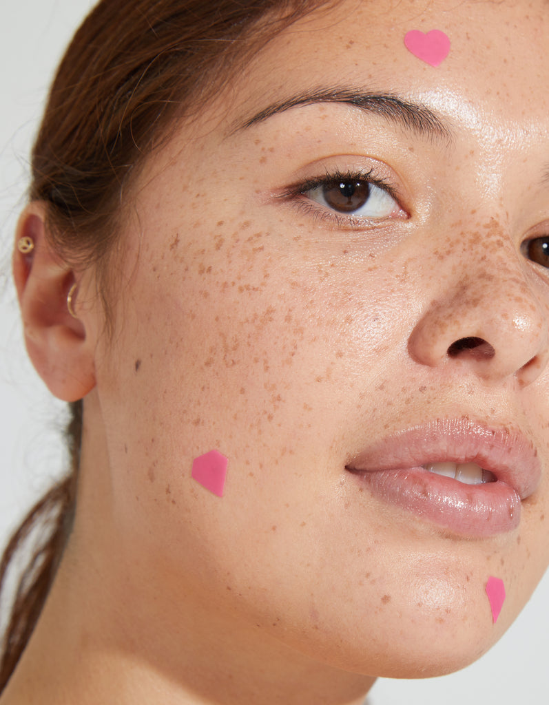 What Are Acne Patches + Do They Work?